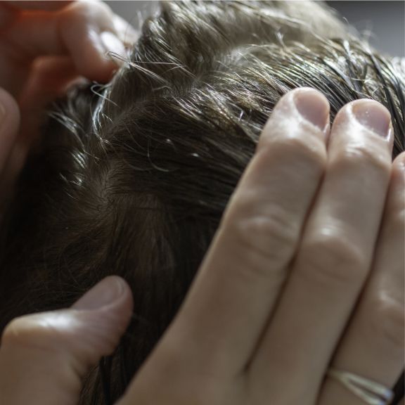 clinician checking child's head for lice